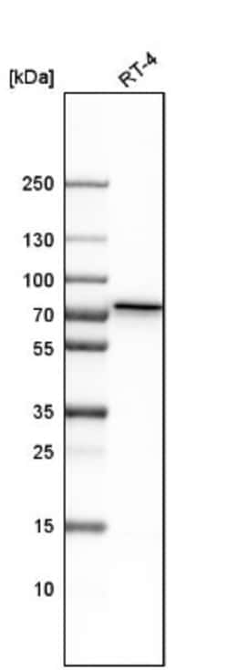 Polypeptide GalNac Transferase 1/GALNT1 Antibody, Novus Biologicals:Anticuerpos:Anticuerpos